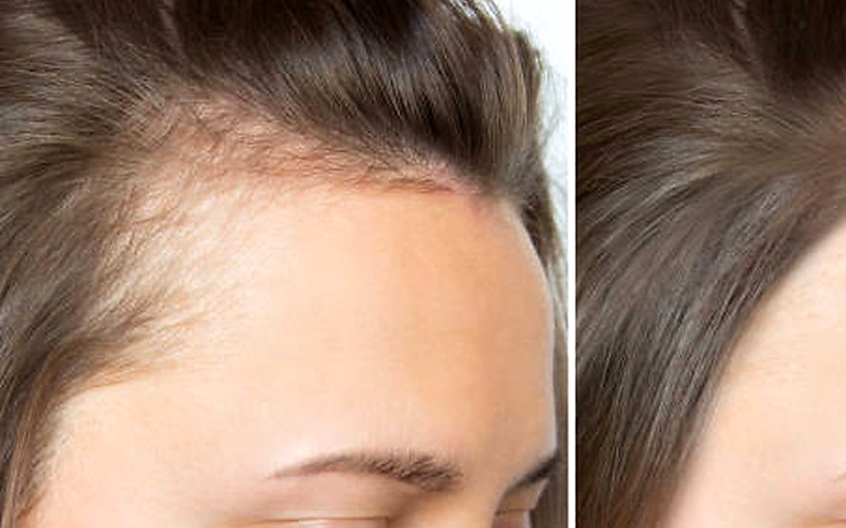 Hair Growth category